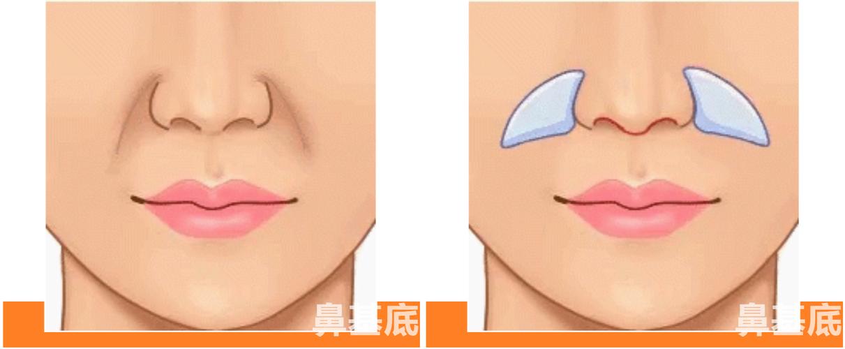 鼻基底宽和鼻翼宽的区别？（鼻翼含义）-图2