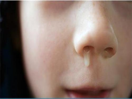 为什么人在哭的时候会流鼻涕？（鼻涕横流的含义）-图3